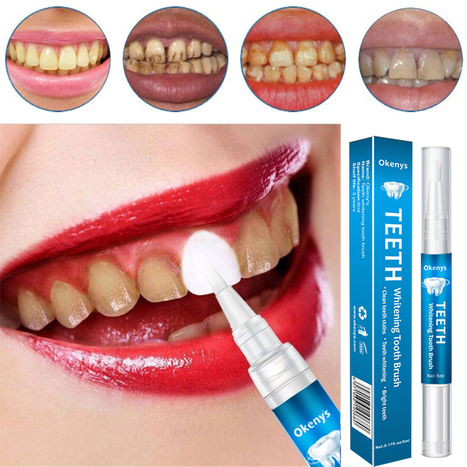 Whitening Pen Bleach - Kit de Blanchiment des Dents avec