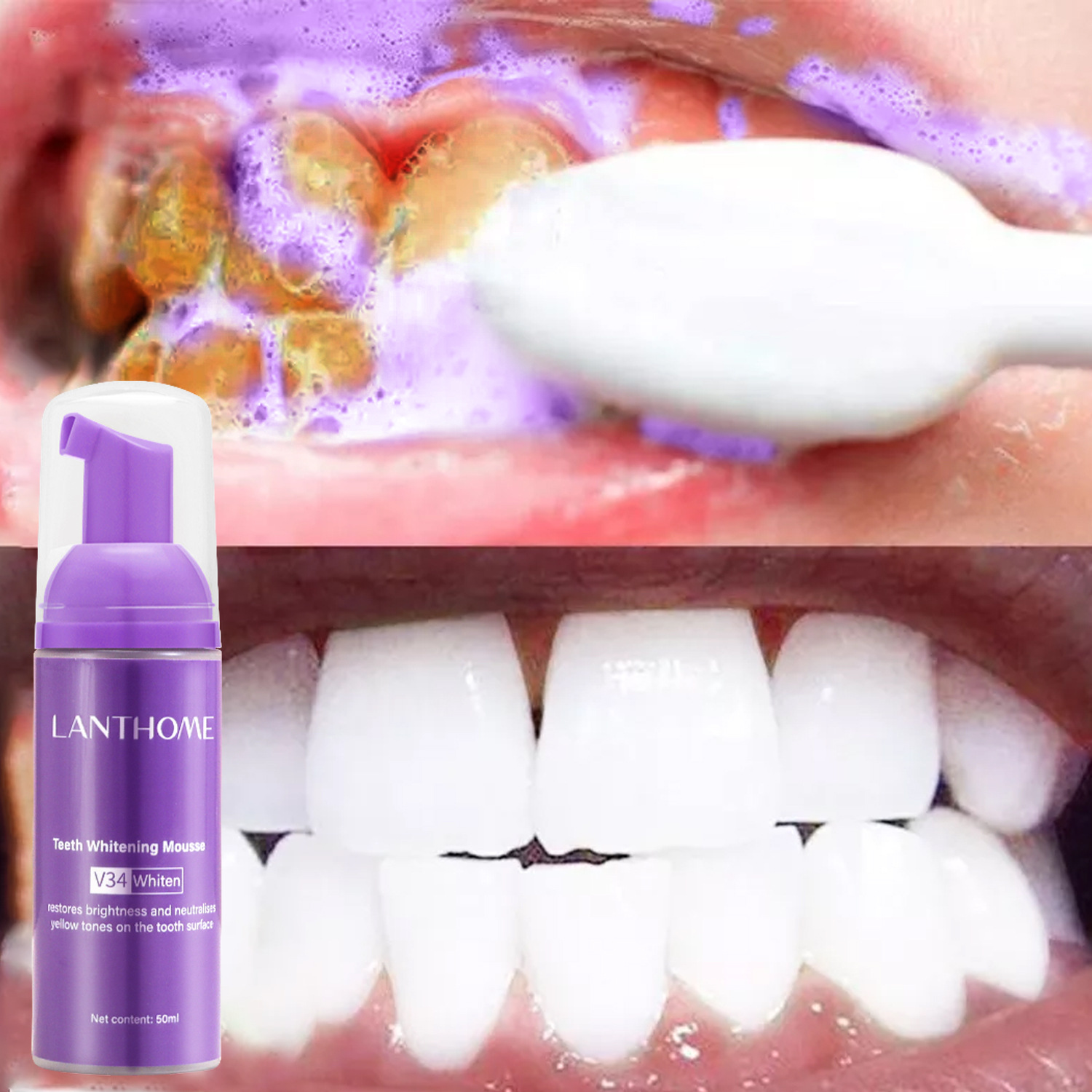 Teeth Whitening/Bleaching - Mousse de blanchiment des dents V34,