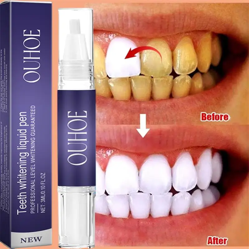 Whitening Pen Bleach - Stylo dentifrice à blanchiment rapide des
