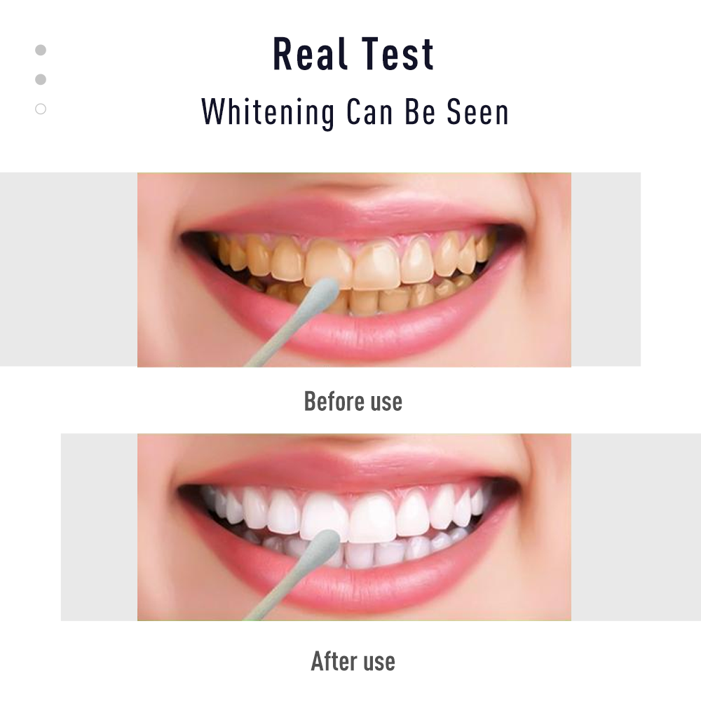 Stylo gel dentaire blanc, kit  - Whitening Pen Bleach avis et prix