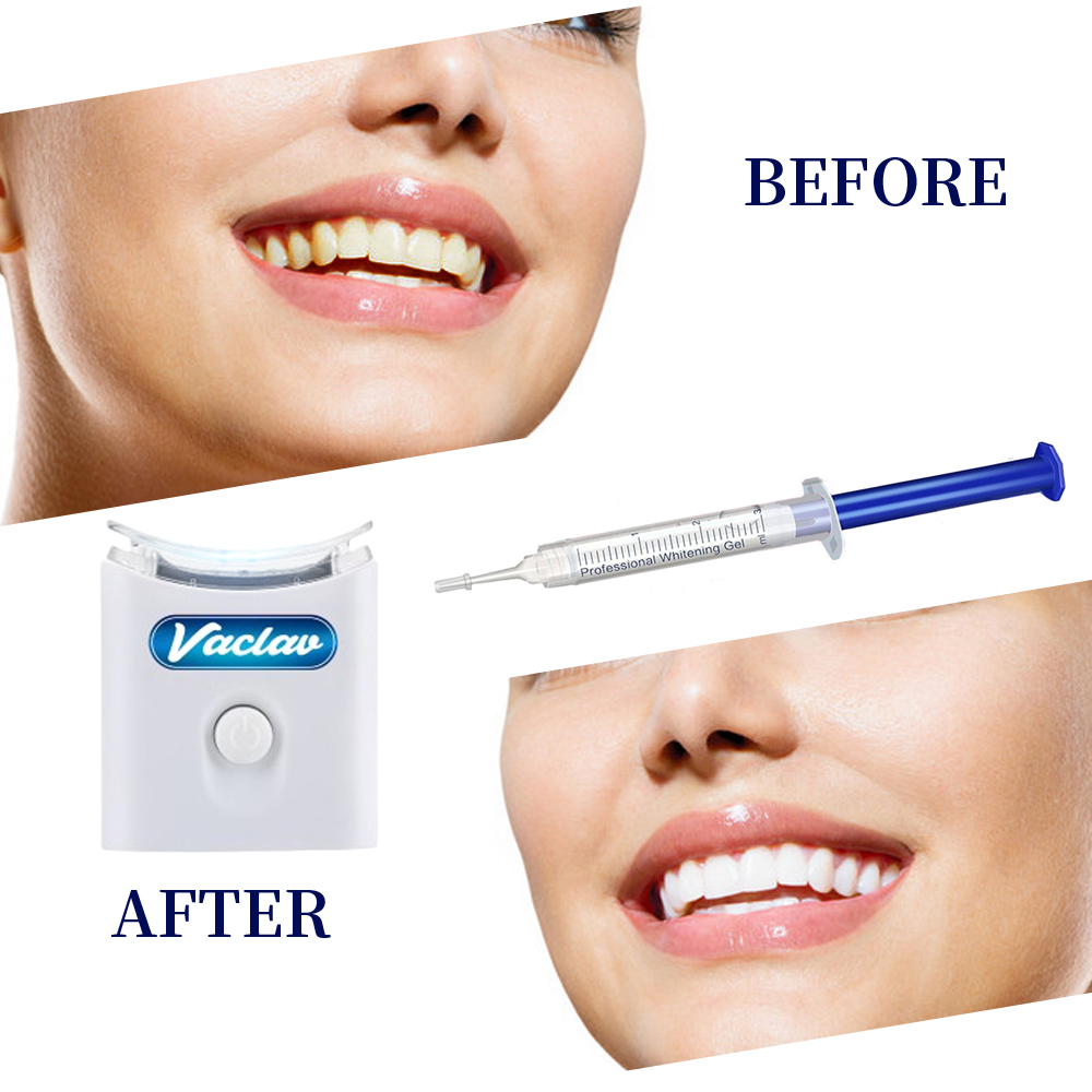 Seringue de Gel de blanchiment - Teeth Whitening Gel Syringes avis et prix