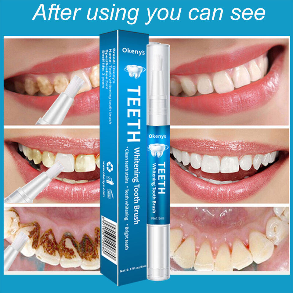 Kit de Blanchiment des Dents a - Whitening Pen Bleach avis et prix