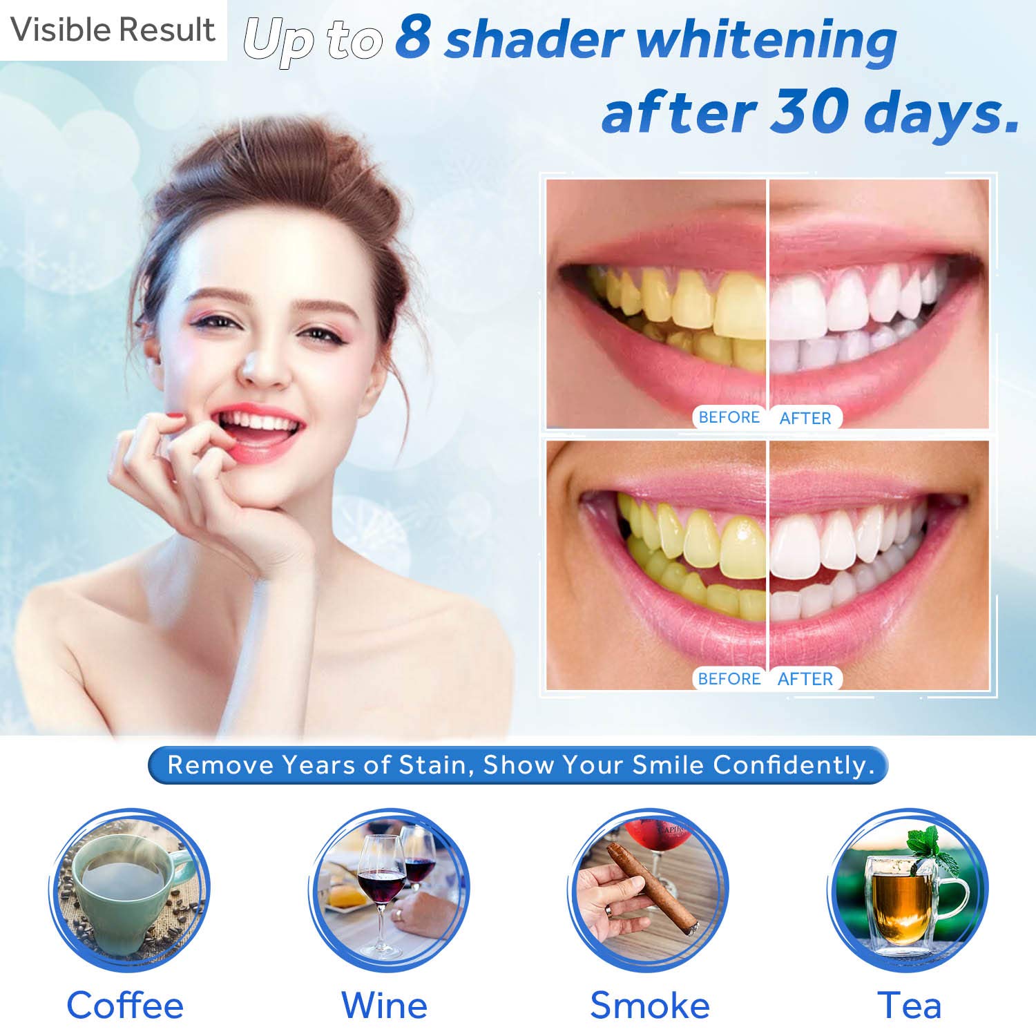 Gel de blanchiment des dents r - Teeth Whitening Gel Syringes avis et prix