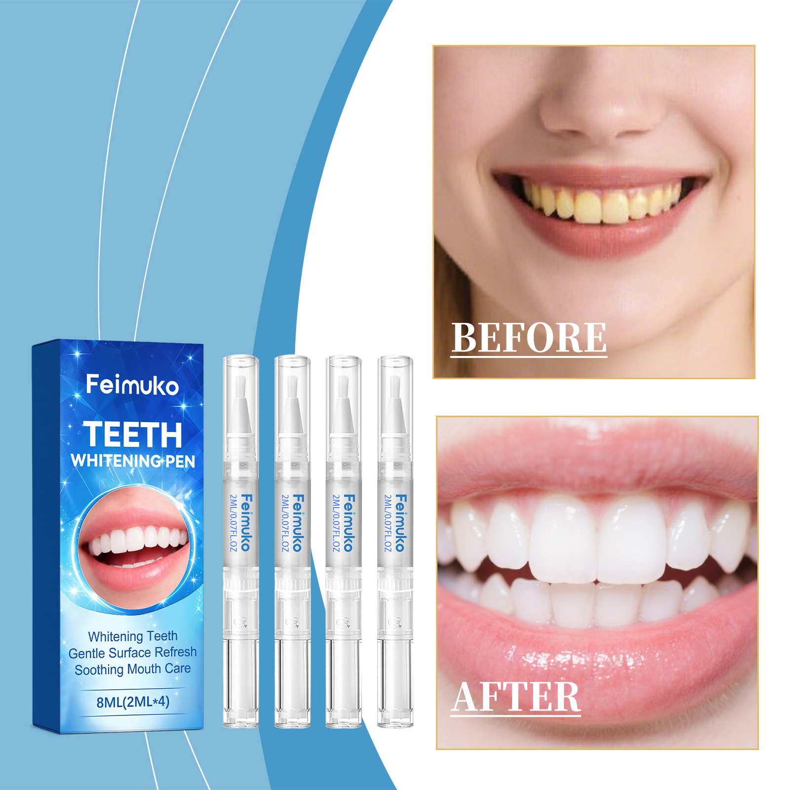 Feimuko 8ml Stylo Gel Dentaire - Teeth Whitening Gel Pen avis et prix