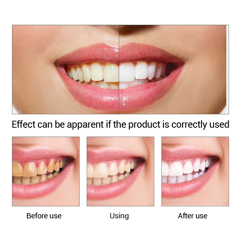 FTEENPLY poudre d'essence de b - Teeth Whitening Paste avis et prix