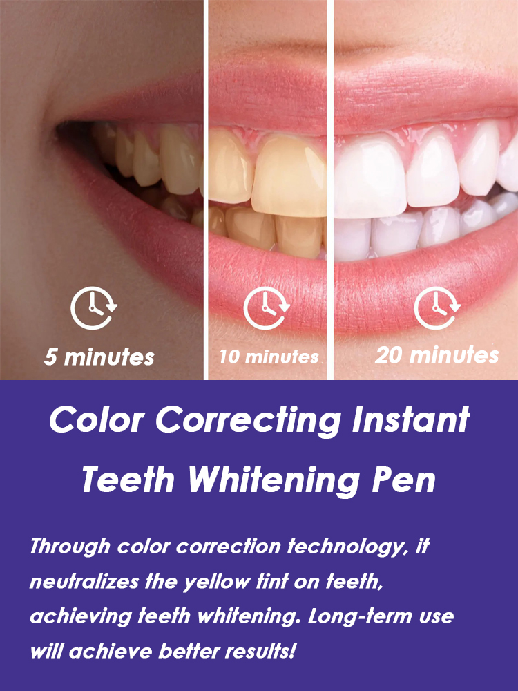 Stylo blanchissant pour les de - Whitening Pen Bleach avis et prix