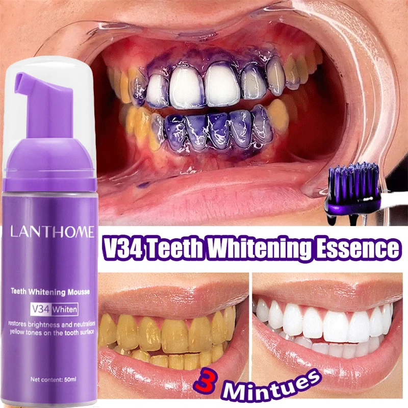 Mousse de blanchiment des dent - Teeth Whitening/Bleaching avis et prix