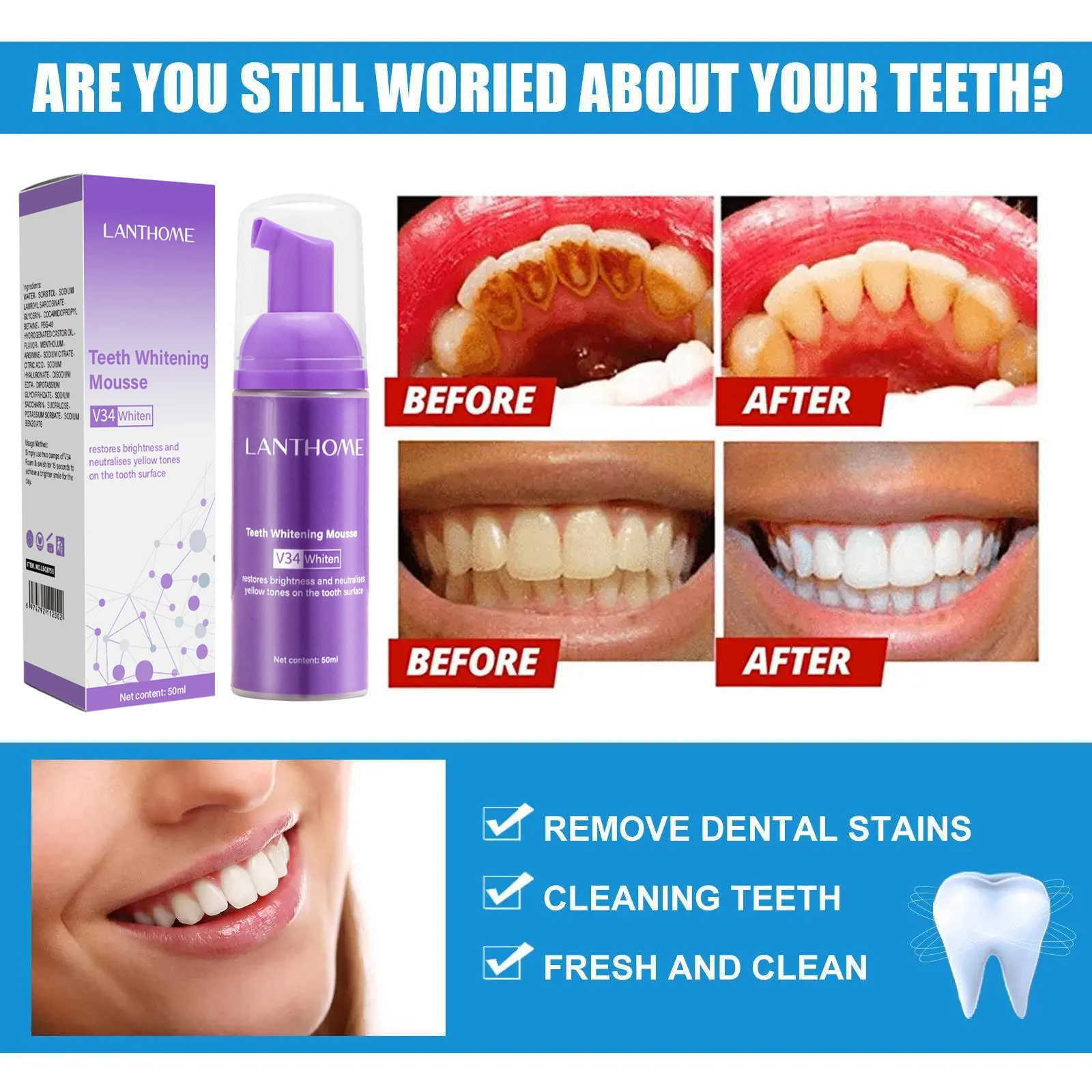 Mousse de blanchiment des dent - Teeth Whitening/Bleaching avis et prix
