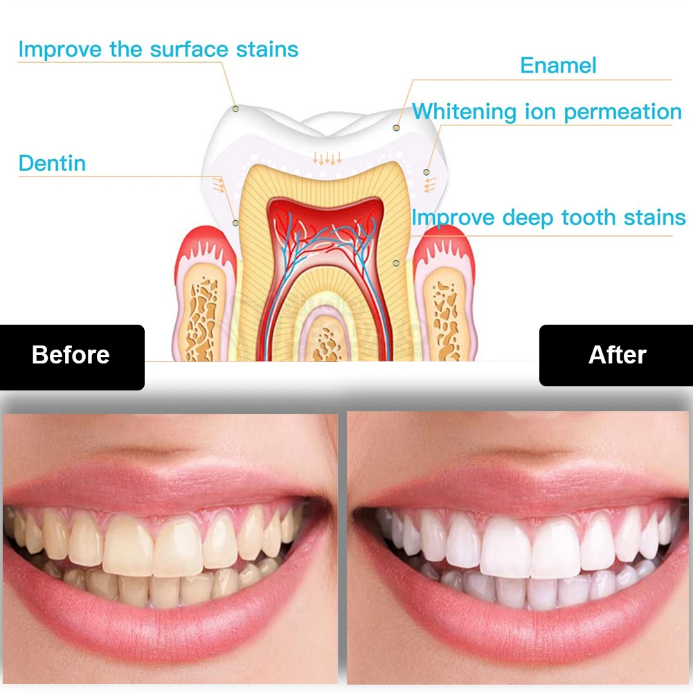Kit de blanchiment des dents d - Whitening Pen Bleach avis et prix