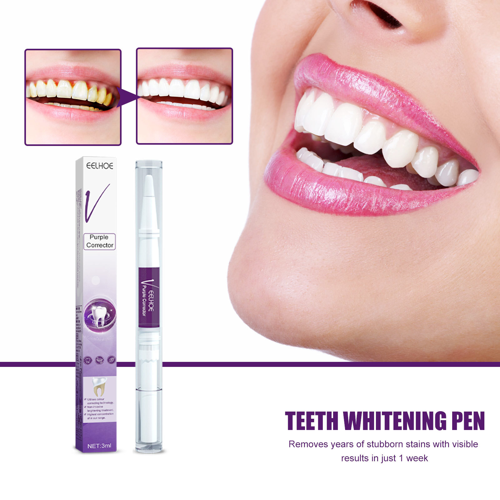 Stylo dentifrice violet pour b - Whitening Pen Bleach avis et prix
