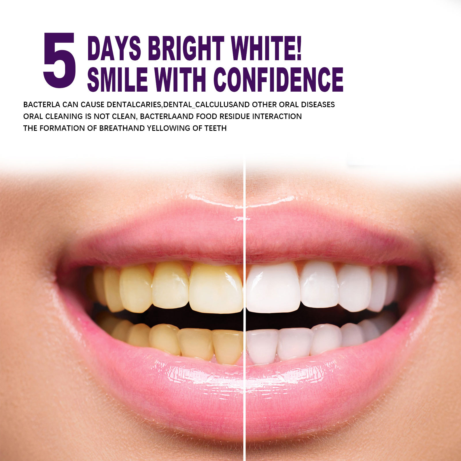 Stylo dentifrice violet pour b - Whitening Pen Bleach avis et prix