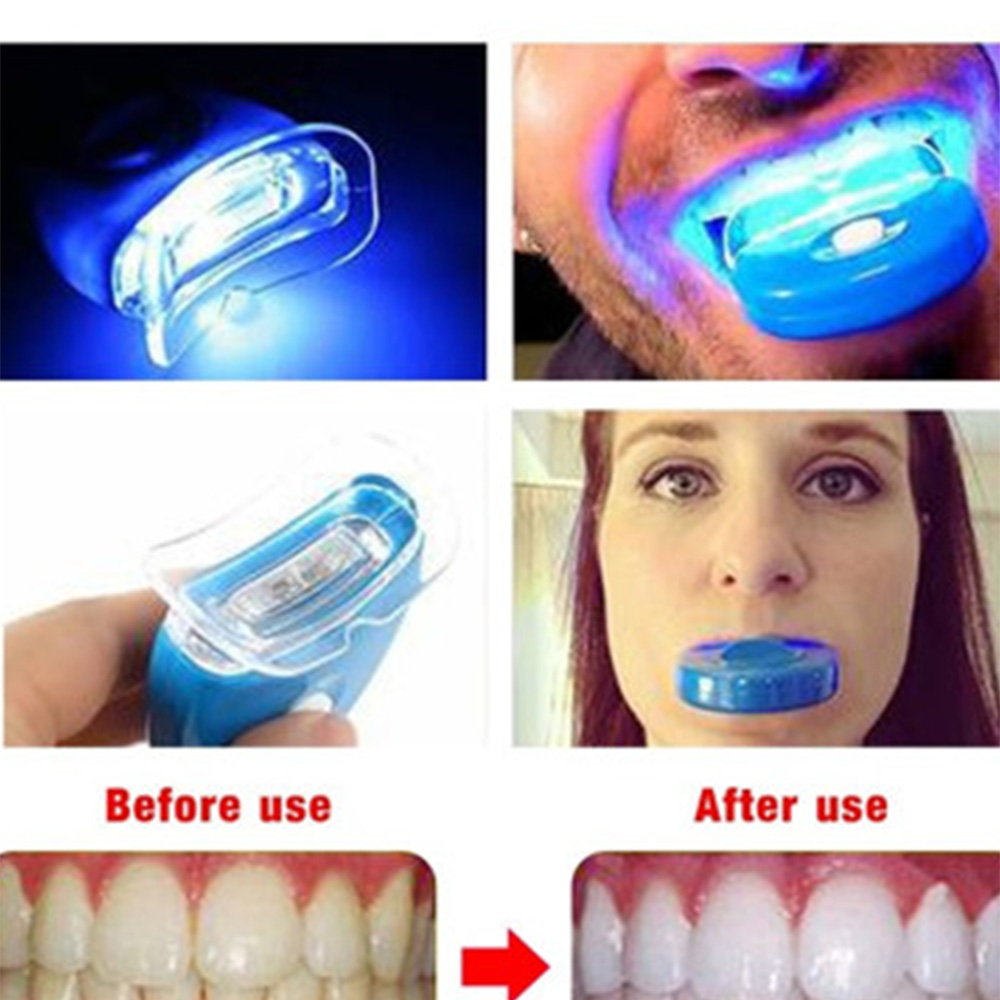 Accélérateur de blanchiment de - Teeth Whitening With Laser avis et prix