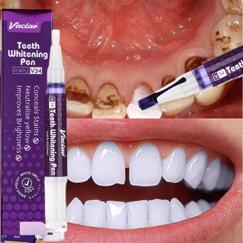 Stylo Blanchissant V34 pour le - Whitening Pen Bleach avis et prix