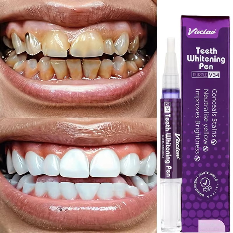 Stylo Blanchissant V34 pour le - Whitening Pen Bleach avis et prix