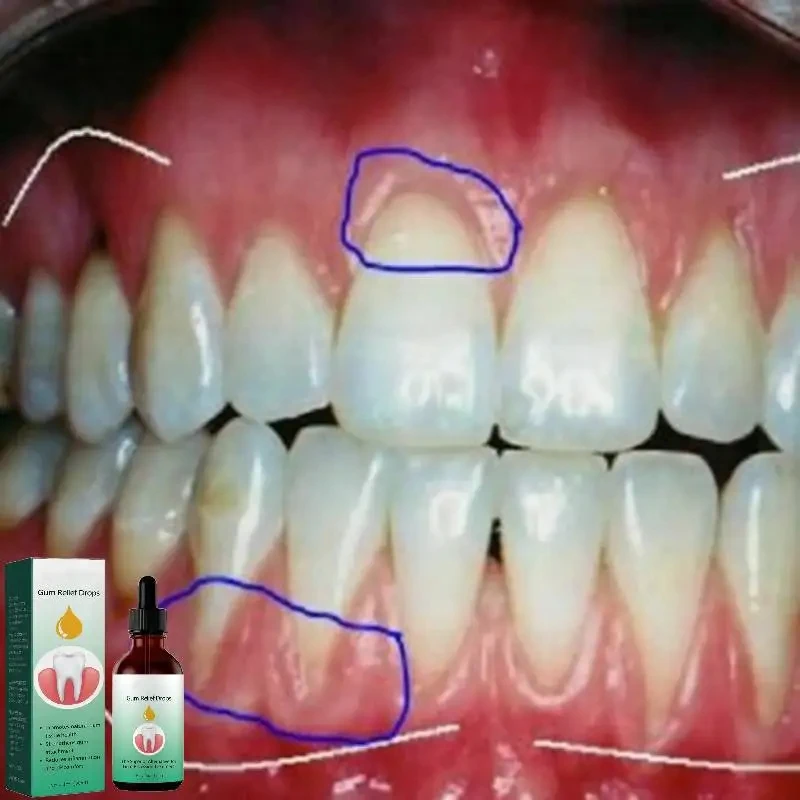 Gouttes de Réparation de Gomme - Teeth Whitening Paste avis et prix