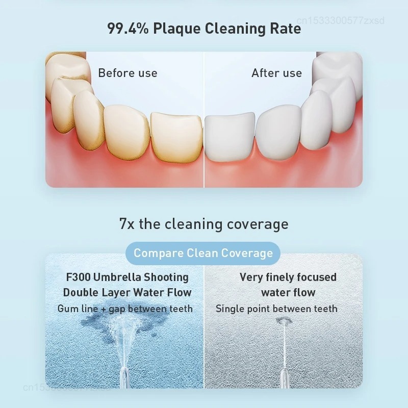 XIAOMI MIJIA Irrigateur buccal - Water Flosser Cordless avis et prix